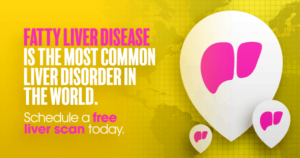 Fatty liver disease is the most common liver disorder in the world