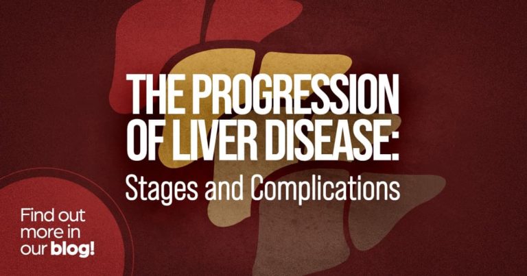 The progression of liver disease: Stages and complications