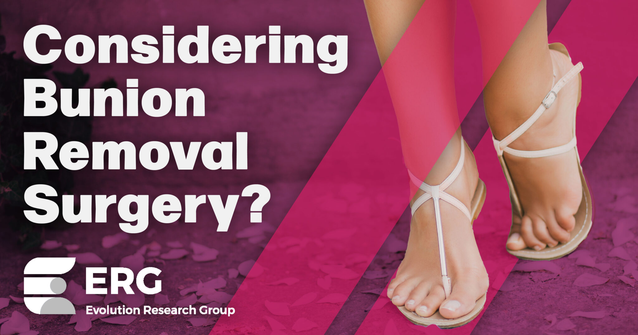 Considering Bunion Removal Surgery Is It Right for You? Evolution